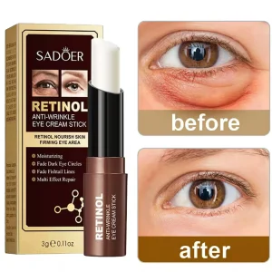 Eye Cream Removing Dark Circles Wrinkle  Lightening Fine Lines Moisturizing Whitening Skin Care